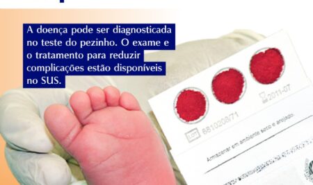 27 de Outubro – Dia Nacional de Luta pelos Direitos das Pessoas com Doenças Falciformes